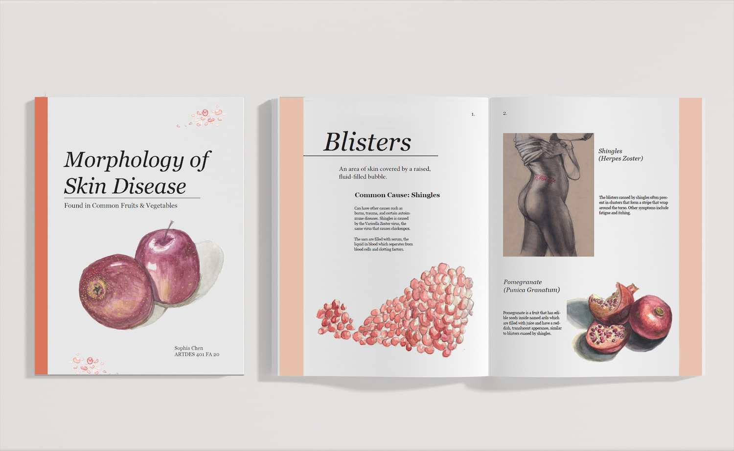 This is a mockup of the physical book I made. On the cover, there are two apples drawn in watercolor, with such extraordinary craftsmanship that real apples will be put to shame. The first page contains a short introduction of blisters, and the second page contains a figure exhibiting those symptoms, below it are two pomegranates.