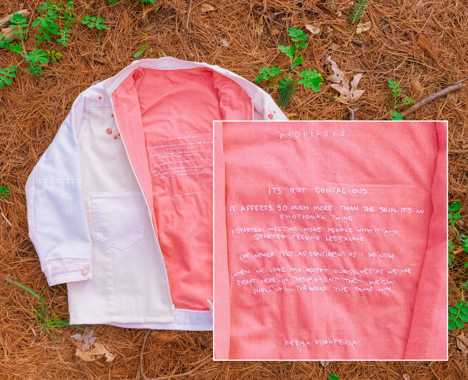 Psoriasis jacket, placed on the ground, partially opened